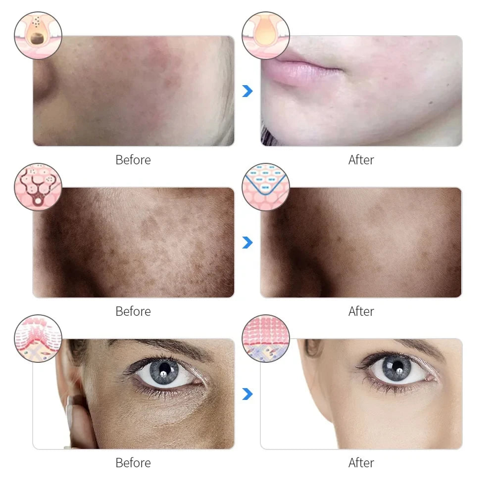 Mascarilla LED Facial Recargable 7 Colores | Fototerapia para Acné, Arrugas y Rejuvenecimiento